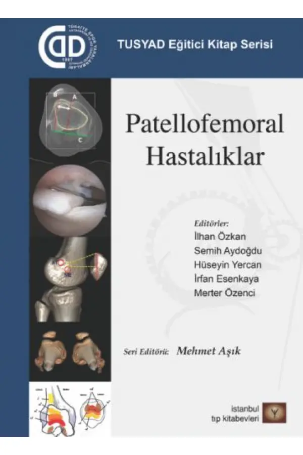 TUSYAD Eğitici Kitap Serisi - Patellofemoral Hastalıklar TUSYAD Eğitici Kitap Serisi - Patellofemoral Hastalıklar