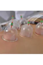 Hacamat Kupa Seti 6 Adet Hacamat Kupa Seti 6 Adet